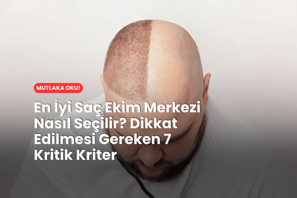 En İyi Saç Ekim Merkezi Nasıl Seçilir? Dikkat Edilmesi Gereken 7 Kritik Kriter Ne